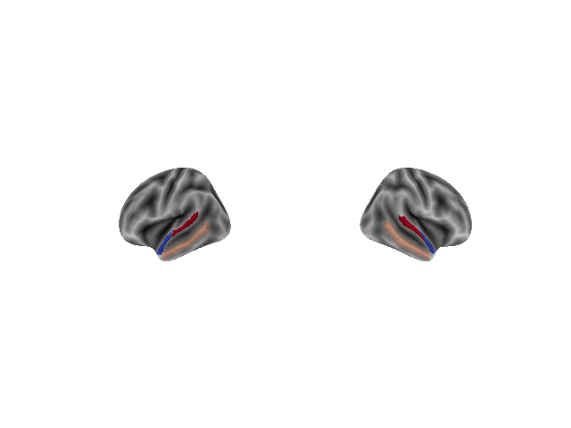 plot intracranial electrodes